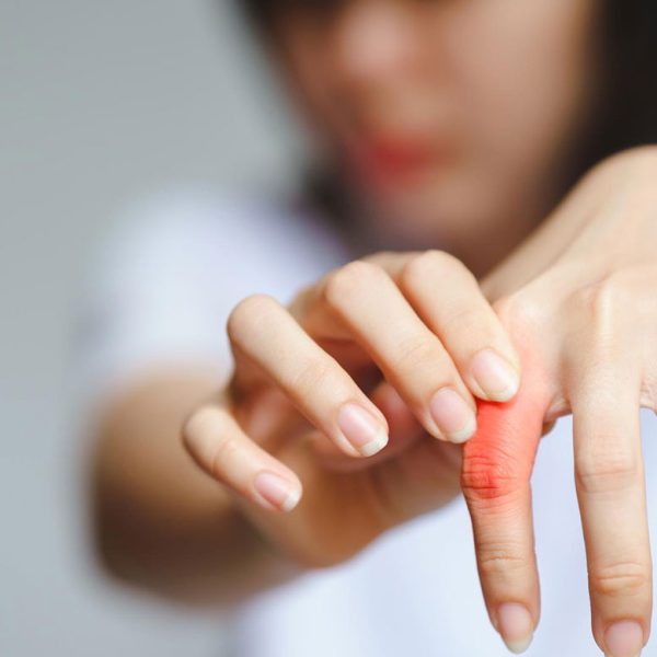 blog-rheumatology