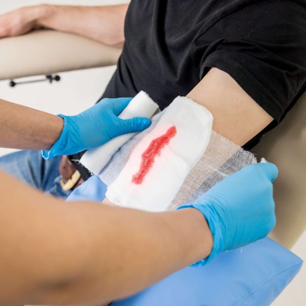 traumatic-wound-treatment-scaled